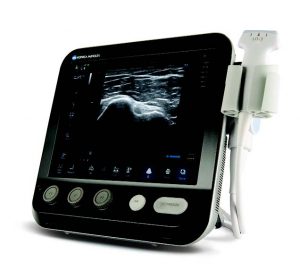 Konica Minolta Sonimage MX1 Portable Ultrasound Machine